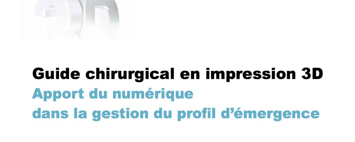 Article Guide chirurgical et impression 3D Bordeaux