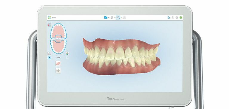 Empreintes-Numerique-Digital-dentiste-bordeaux